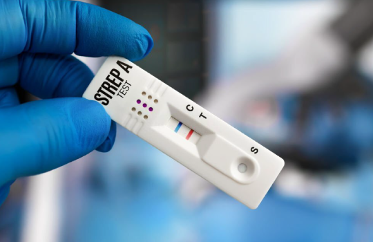 Teste rápido para detecção de Streptococcus do grupo A (Strep A), utilizado no diagnóstico de infecção bacteriana na garganta, como amigdalite ou faringite