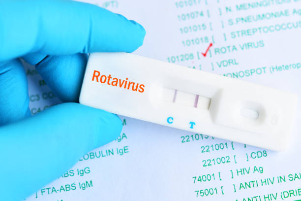 Teste rápido para detecção de Rotavírus, utilizado no diagnóstico de infecções gastrointestinais, especialmente em crianças com sintomas de diarreia e desidratação.